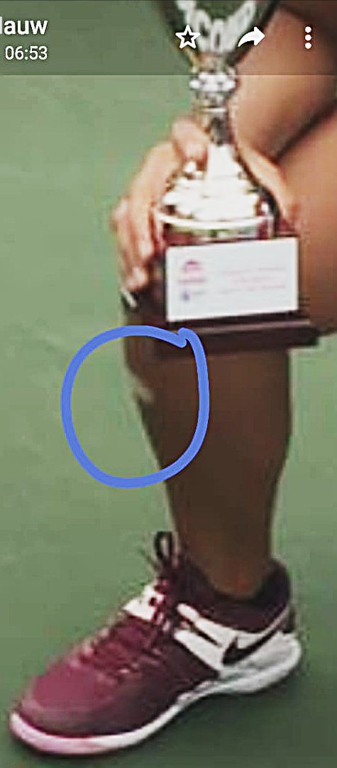 Tennis patch image